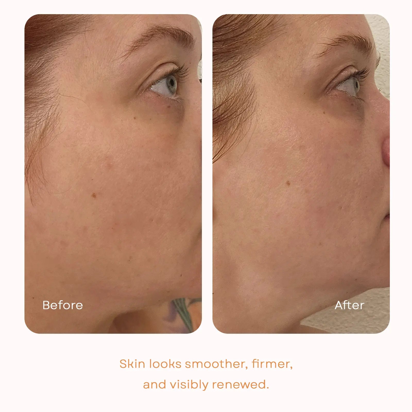 Izumi Skin Regenerating Serum